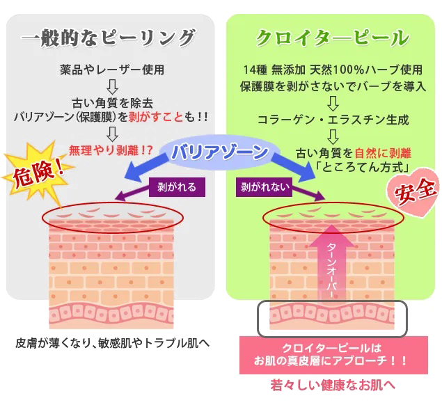 Cloeter果皮